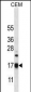 MRPS12 Antibody (Center K43)